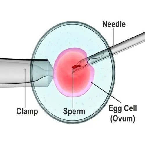 icsi-treatment-in-india